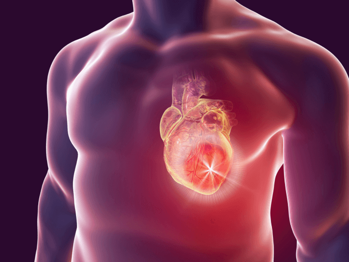 Az angina pectoris rizikófaktorai