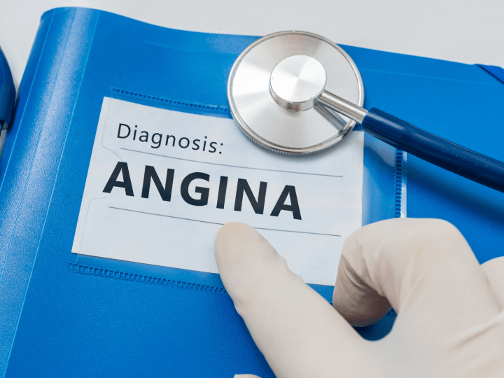 Az angina pectoris további jellemző tünetei